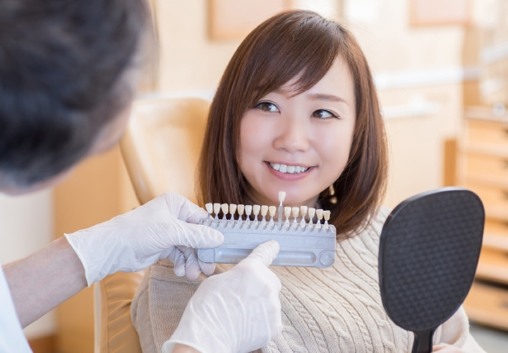 シェードガイドによる色調の確認