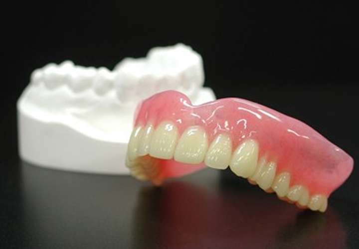 型取り（印象採得）