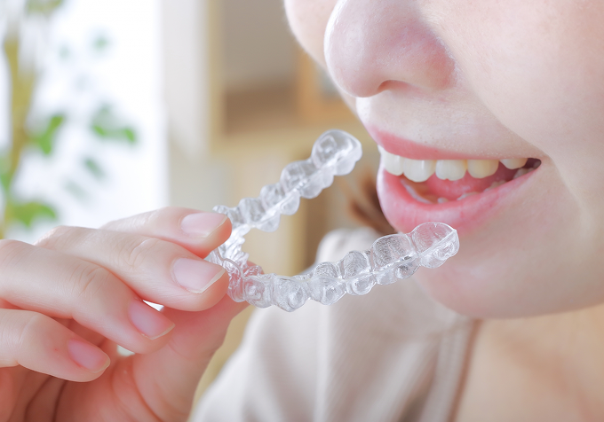 インビザライン
