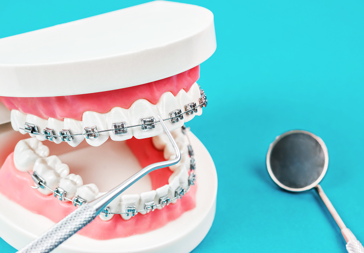 治療期間・費用に関する事前説明