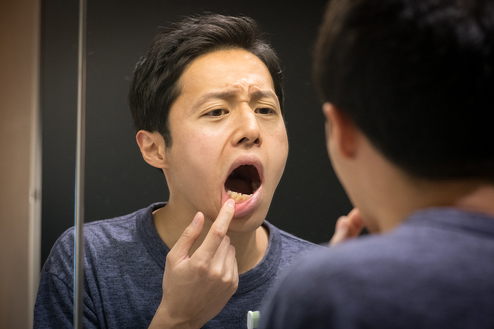 ホワイトニング